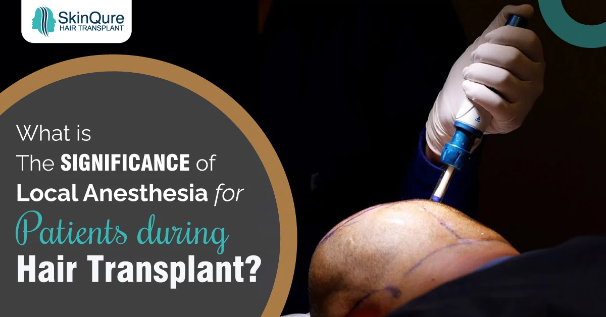 Local anesthesia during hair transplant - SkinQure, Delhi
