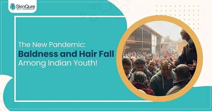 The New Pandemic: Baldness and Hair Fall among Indian Youth - SkinQure, Delhi