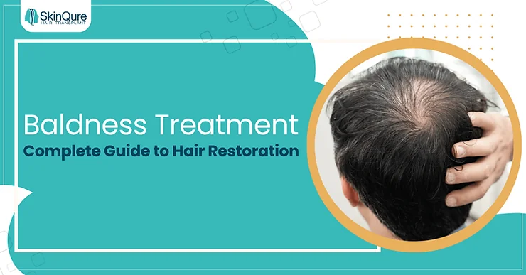 Baldness Treatment: Complete Guide to Hair Restoration - SkinQure, Delhi