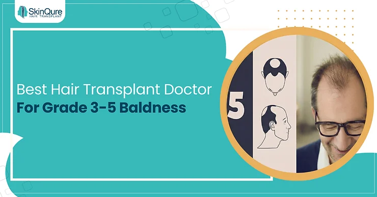 Experienced Hair Transplant Doctor in Delhi for Grade 3-5 Baldness - SkinQure, Delhi