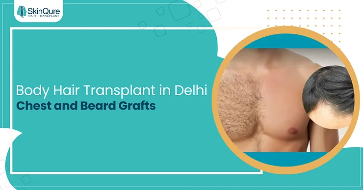 Body Hair Transplant in Delhi Chest and Beard Grafts - SkinQure, Delhi