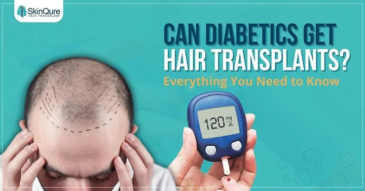 Can Diabetics Get Hair Transplants? Everything You Need to Know - SkinQure, Delhi