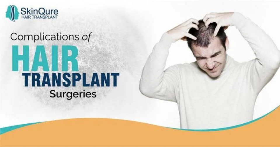 Complications and side effects of hair transplant - SkinQure, Delhi