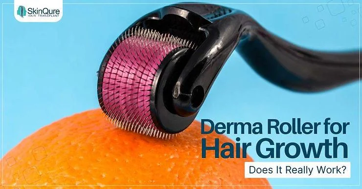 Derma Roller for Hair Growth: Does It Really Work? - SkinQure, Delhi