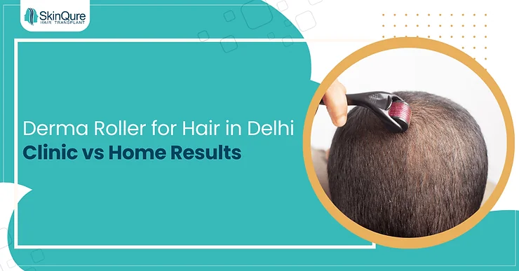 Derma Roller for Hair in Delhi: Clinic vs Home Results - SkinQure, Delhi