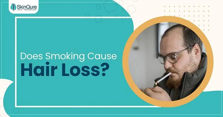 Unveiling the Link: Does Smoking Cause Hair Loss? - SkinQure, Delhi
