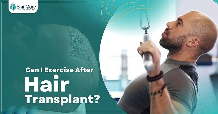 Can I Exercise After a Hair Transplant? - SkinQure, Delhi