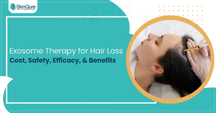 Exosome Therapy for Hair Loss: Cost, Safety, Efficacy, & Benefits - SkinQure, Delhi