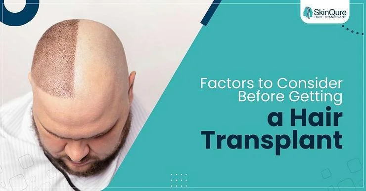 Factors to Consider Before Getting a Hair Transplant - SkinQure, Delhi