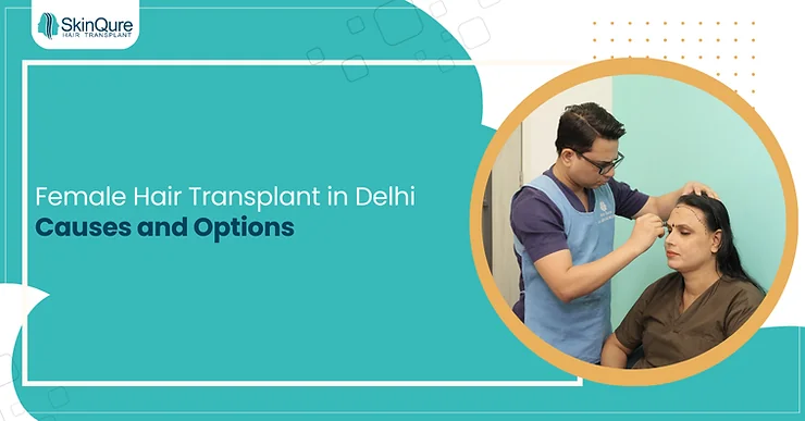Female Hair Transplant in Delhi Causes and Options - SkinQure, Delhi