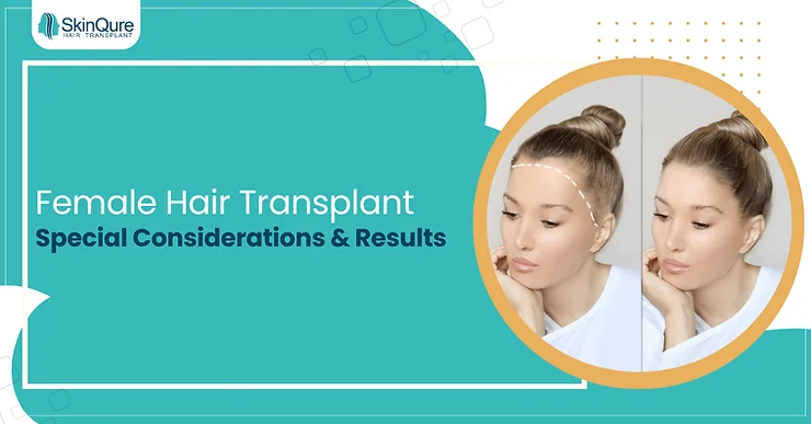 Female Hair Transplant: Special Considerations & Results - SkinQure, Delhi