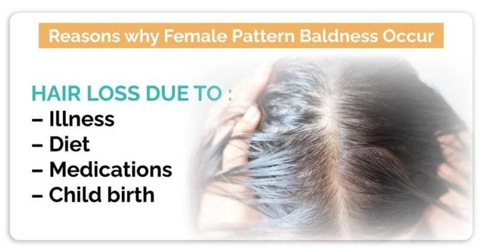 Reasons why female pattern baldness occurs - hair loss due to illness, diet, medications and child birth