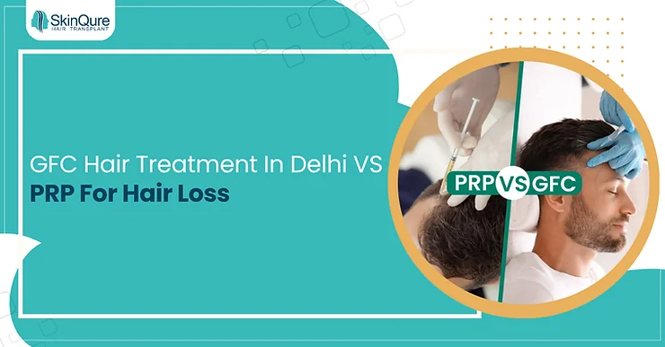 GFC Hair Treatment In Delhi VS PRP For Hair Loss - SkinQure, Delhi
