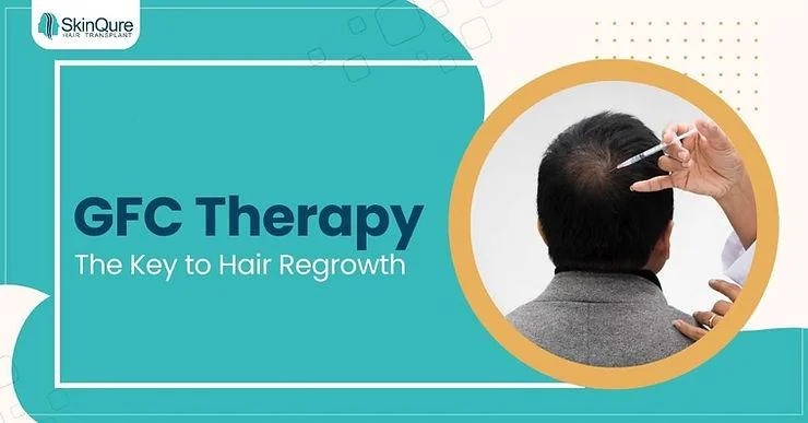 GFC Hair Treatment in Delhi: The Key to Hair Regrowth - SkinQure, Delhi