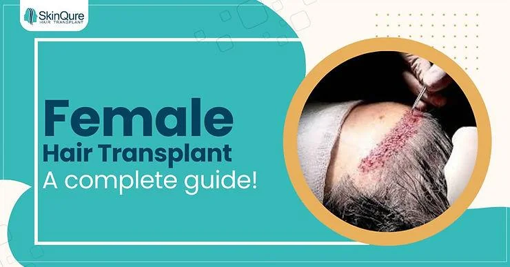 A complete guide to hair transplants for women: How to restore your hair - SkinQure, Delhi