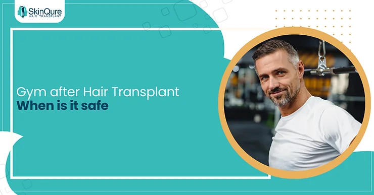 Gym after Hair Transplant: When is it safe - SkinQure, Delhi
