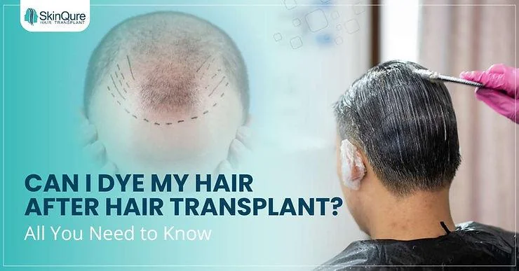 Can I Dye My Hair After Hair Transplant? – All You Need to Know - SkinQure, Delhi