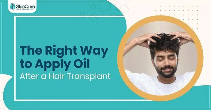 The Right Way to Apply Oil After a Hair Transplant for Best Results - SkinQure, Delhi