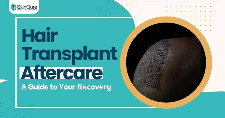 Hair Transplant Aftercare: A Guide to Your Recovery - SkinQure, Delhi