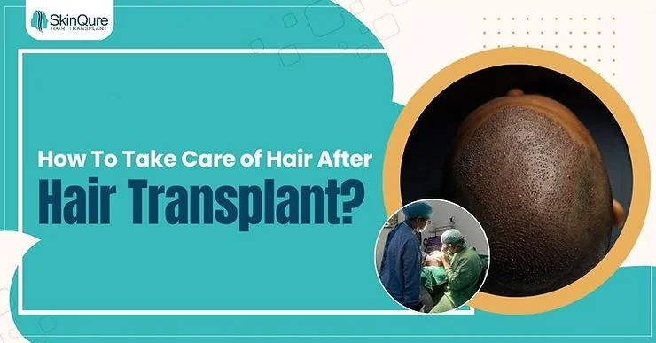 Hair Transplant Aftercare - How To Take Care of Hair After Hair Transplant? - SkinQure, Delhi