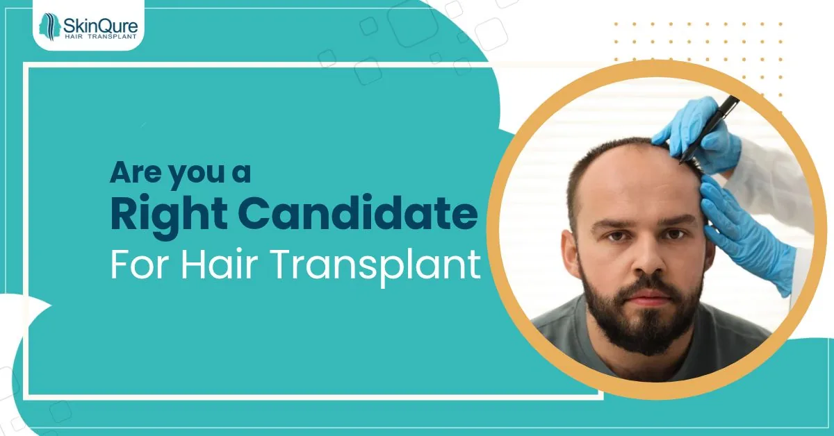 Are You a Right Candidate for Hair Transplant? Hair transplant eligibility - SkinQure, Delhi