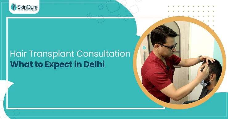 Hair Transplant Consultation: What to Expect in Delhi - SkinQure, Delhi