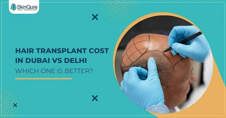 Hair Transplant Cost in Dubai vs Delhi - Which One is Better? - SkinQure, Delhi
