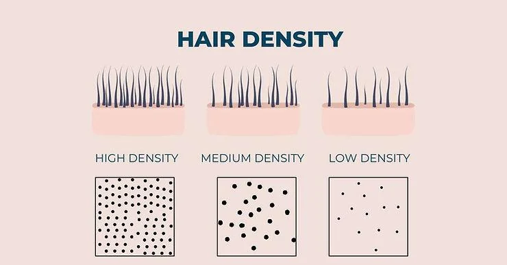 Hair Transplant Density: How Much Density Can Be Achieved? - SkinQure, Delhi