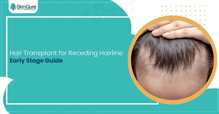 Hair Transplant for Receding Hairline Early Stage Guide - SkinQure, Delhi