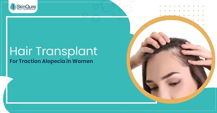 Hair Transplant For Traction Alopecia in Women - SkinQure, Delhi