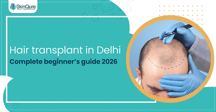 Hair transplant in Delhi: complete beginner’s guide 2026 - SkinQure, Delhi