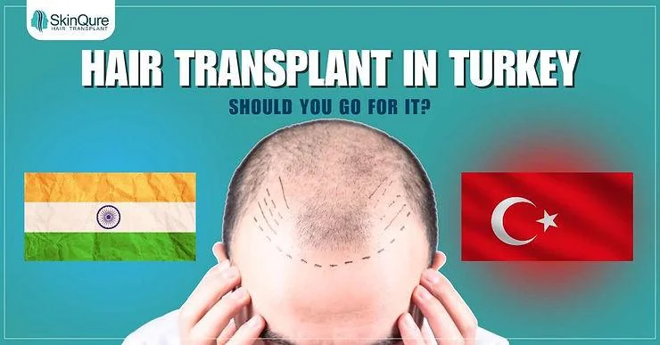 Hair Transplant in Turkey: Should You Go For It? - SkinQure, Delhi