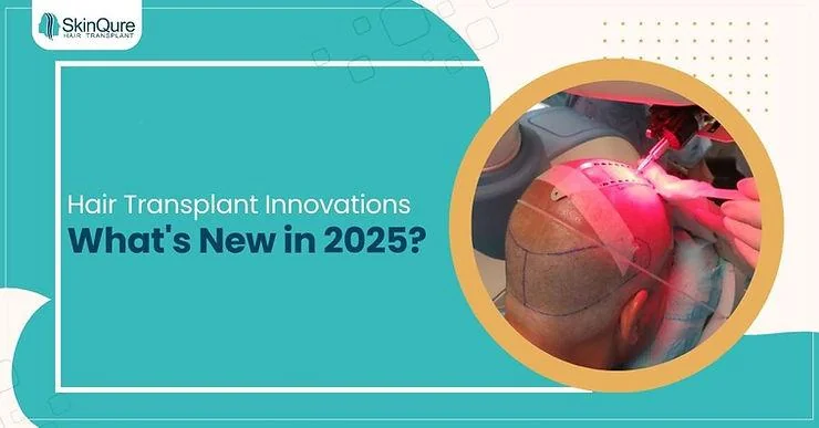 Hair Transplant Innovations: What's New in 2025? - SkinQure, Delhi
