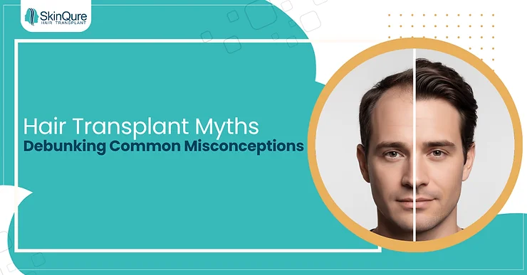 Hair Transplant Myths: Debunking Common Misconceptions - SkinQure, Delhi