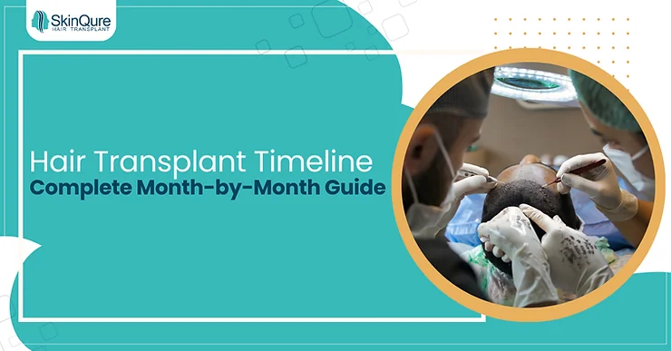 Hair Transplant Timeline: Complete Month-by-Month Guide - SkinQure, Delhi