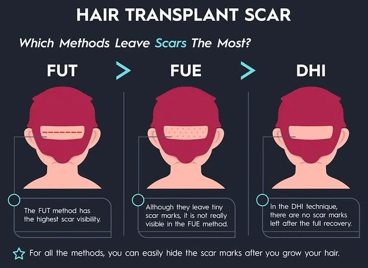 Hair Transplant Scars Healing Guide - SkinQure, Delhi