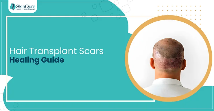 Hair Transplant Scars Healing Guide - SkinQure, Delhi