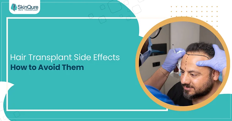 Hair Transplant Side Effects and How to Avoid Them - SkinQure, Delhi