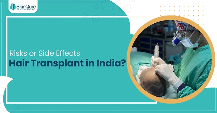 What are the risks or side effects of hair transplant in India? - SkinQure, Delhi