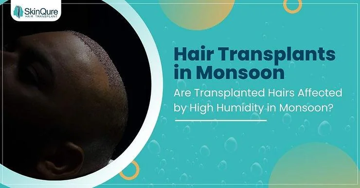 Hair Transplants in Monsoon: Are Transplanted Hairs Affected by High Humidity in Monsoon? - SkinQure, Delhi