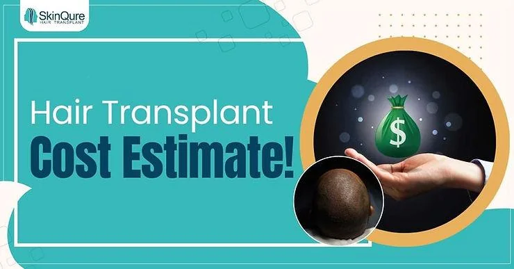 How is the cost of a hair transplant calculated in Delhi? - SkinQure, Delhi