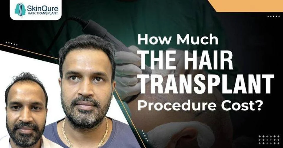 How much the hair transplant procedure cost - SkinQure, Delhi