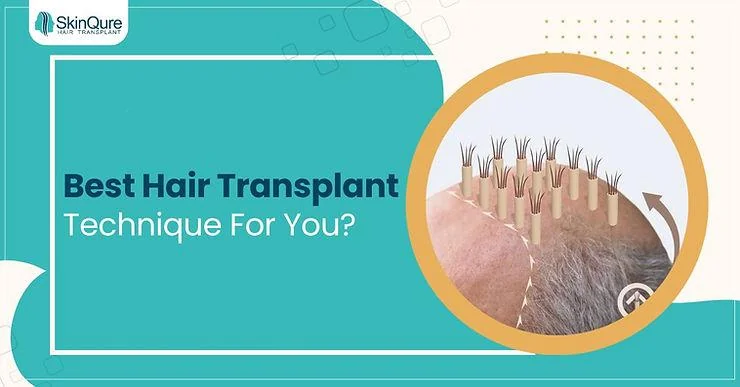 How to Choose the Best Hair Transplant Technique for You? - SkinQure, Delhi