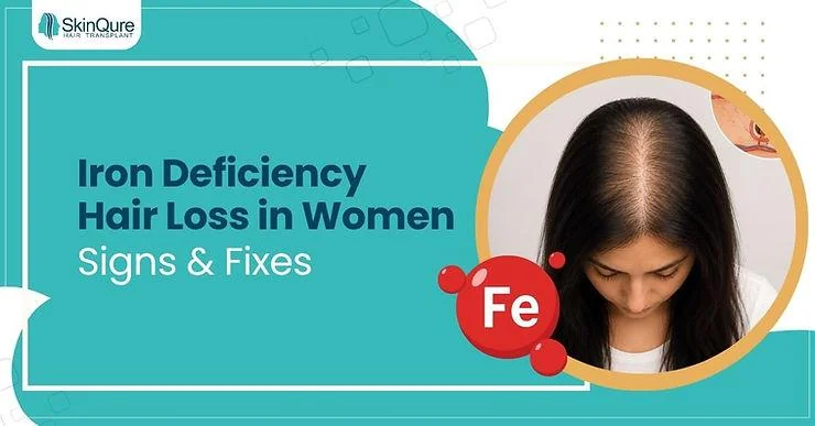 Iron Deficiency Hair Loss in Women: Signs & Fixes - SkinQure, Delhi