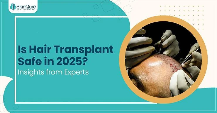 Is Hair Transplant Safe in 2025? Insights from Experts - SkinQure, Delhi