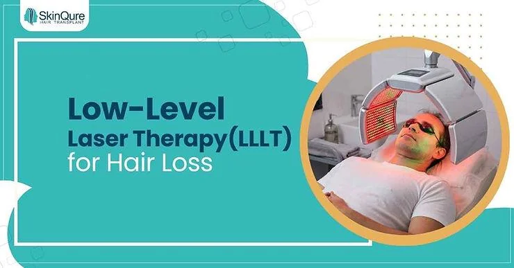 Low-Level Laser Therapy for Hair Loss Explained - SkinQure, Delhi