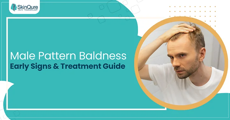 Male Pattern Baldness: Early Signs & Treatment Guide - SkinQure, Delhi
