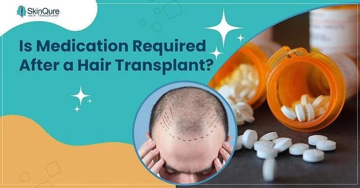 Is Medication Required After a Hair Transplant? - SkinQure, Delhi