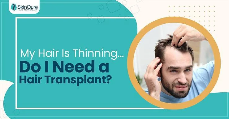 My hair is thinning. Do I need a transplant? - SkinQure, Delhi