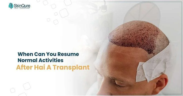 When Can You Resume Normal Activities After a Hair Transplant? - SkinQure, Delhi